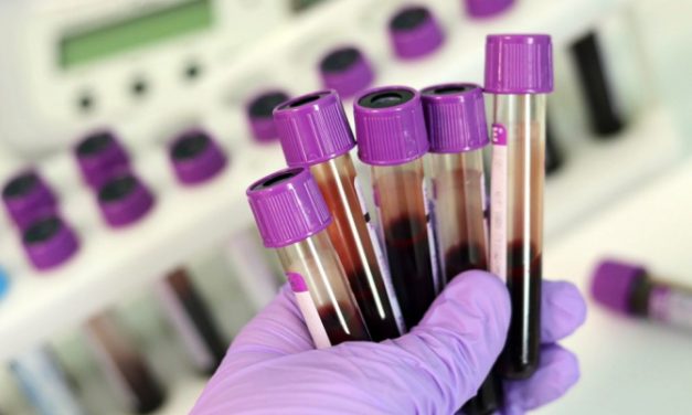 Ministerul Sănătății anunță teste gratuite pentru virusurile hepatitice B și C la persoane cu simptome sugestive