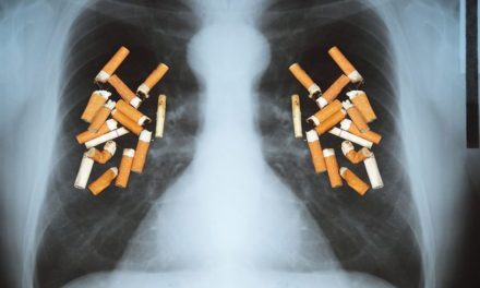 Românii pot afla online dacă plămânii lor prezintă simptomele unui cancer pulmonar