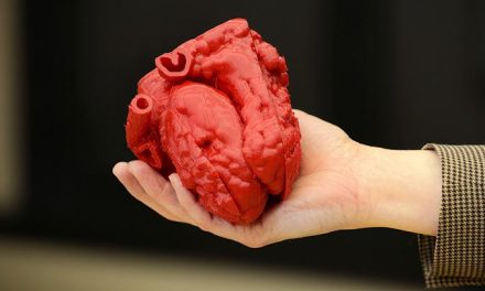 Inimă 3D după imaginile obţinute prin CT de la un pacient, printată în premieră naţională la Congresul CardioNET