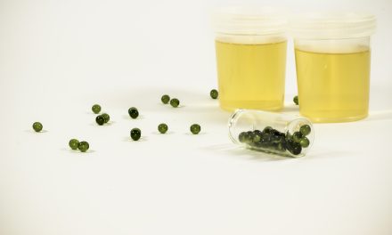 Studiu: Infecțiile urinare complicate prezintă rate ridicate ale rezistenței la antibioticele utilizate în mod obișnuit