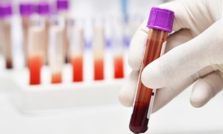 Un nou test de sânge ajută la evaluarea severității hipertensiunii arteriale pulmonare, o afecțiune rară