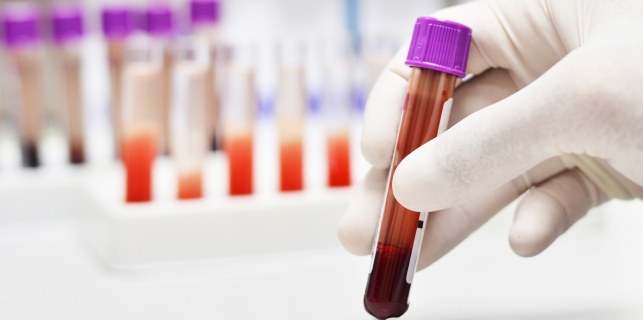 Un nou test de sânge ajută la evaluarea severității hipertensiunii arteriale pulmonare, o afecțiune rară