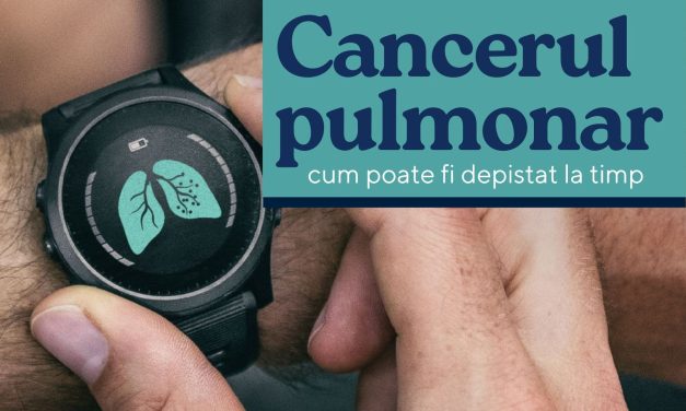 „Cancerul de plămâni – depistarea la timp”, eveniment SRP, 22 noiembrie 2022